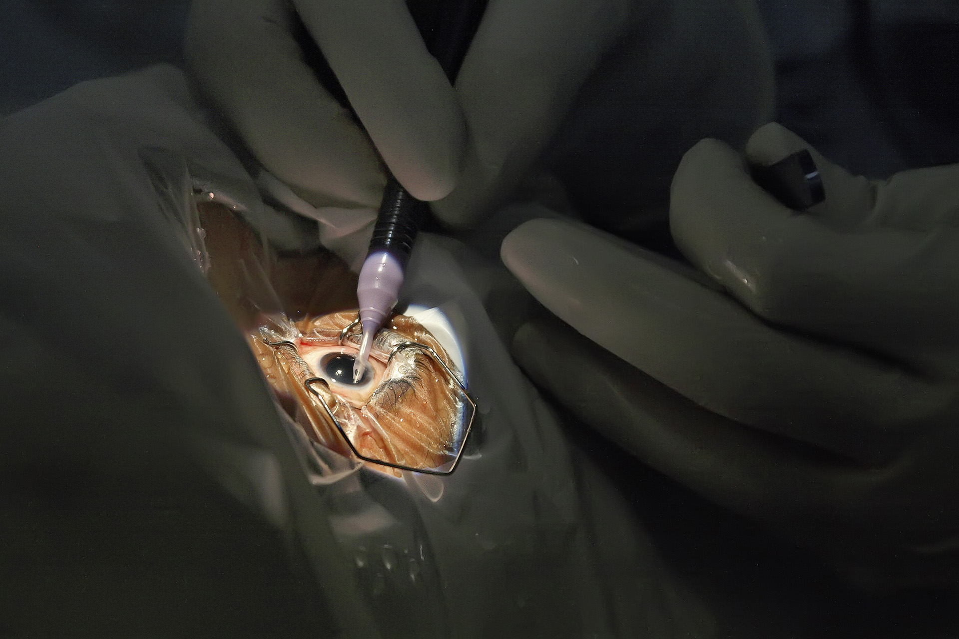Cataract, Theatre 2 — L V Prasad Eye Institute